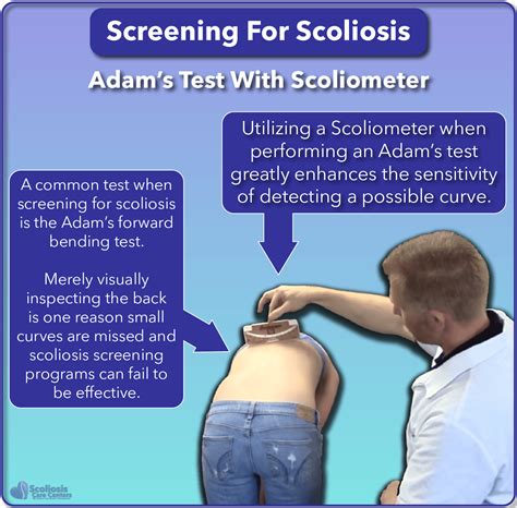 torsion scoliosis test|scoliosis testing results.